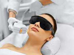 Bilan Epilation lumière pulsée (RDV préalable) image